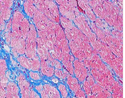  �w�S�M��Ⱦɫ