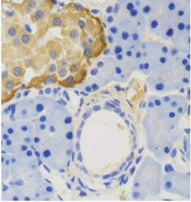 IHC��Ҏ(gu��) /IHC��M�� /IHC�M��оƬ /IHC����оƬ