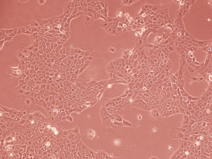 �������Ƥ�Ӹɼ�����WB-F344