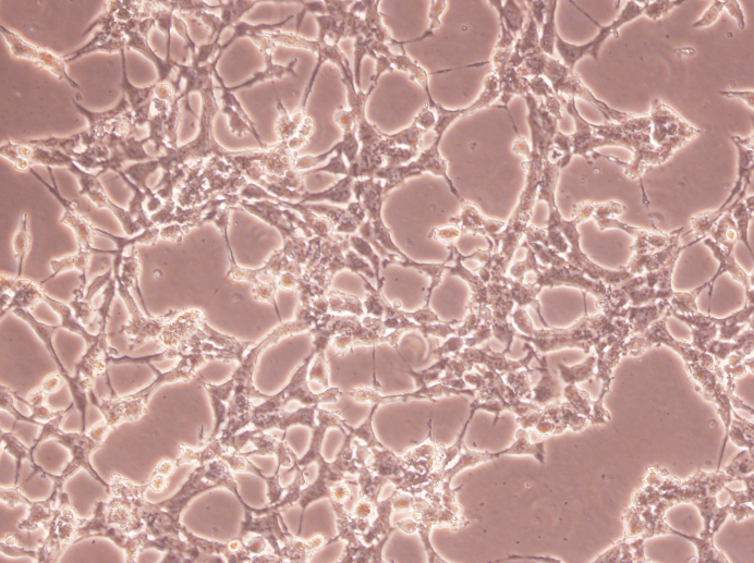 С��Ƥ�½Y(ji��)���M����(x��)��L- cell