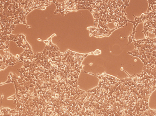 �����ٌ��ܰ�����MDA-MB-134-VI